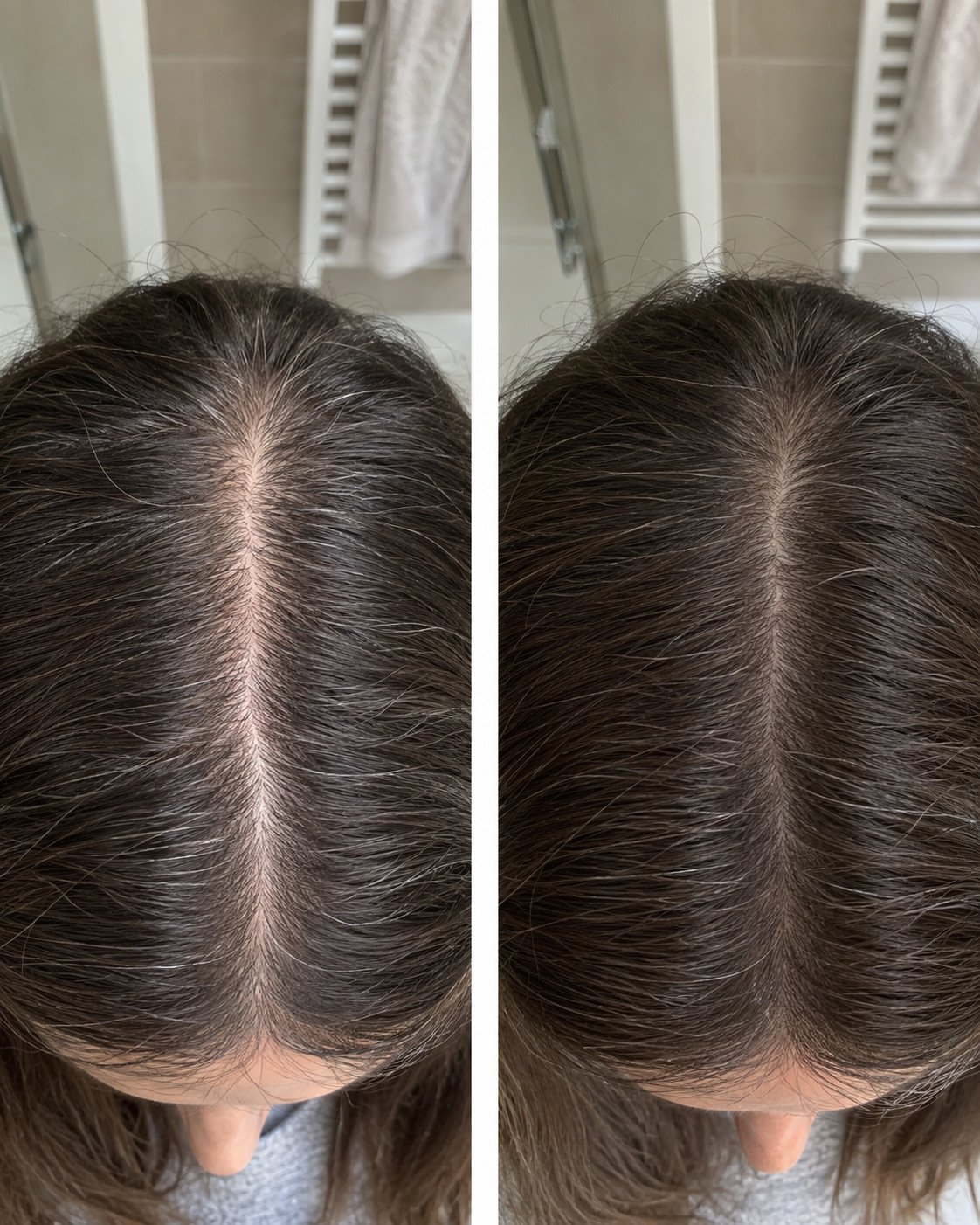 Due fotografie illustrative della riga dei capelli viste dall’alto per osservare i cambiamenti nel tempo.